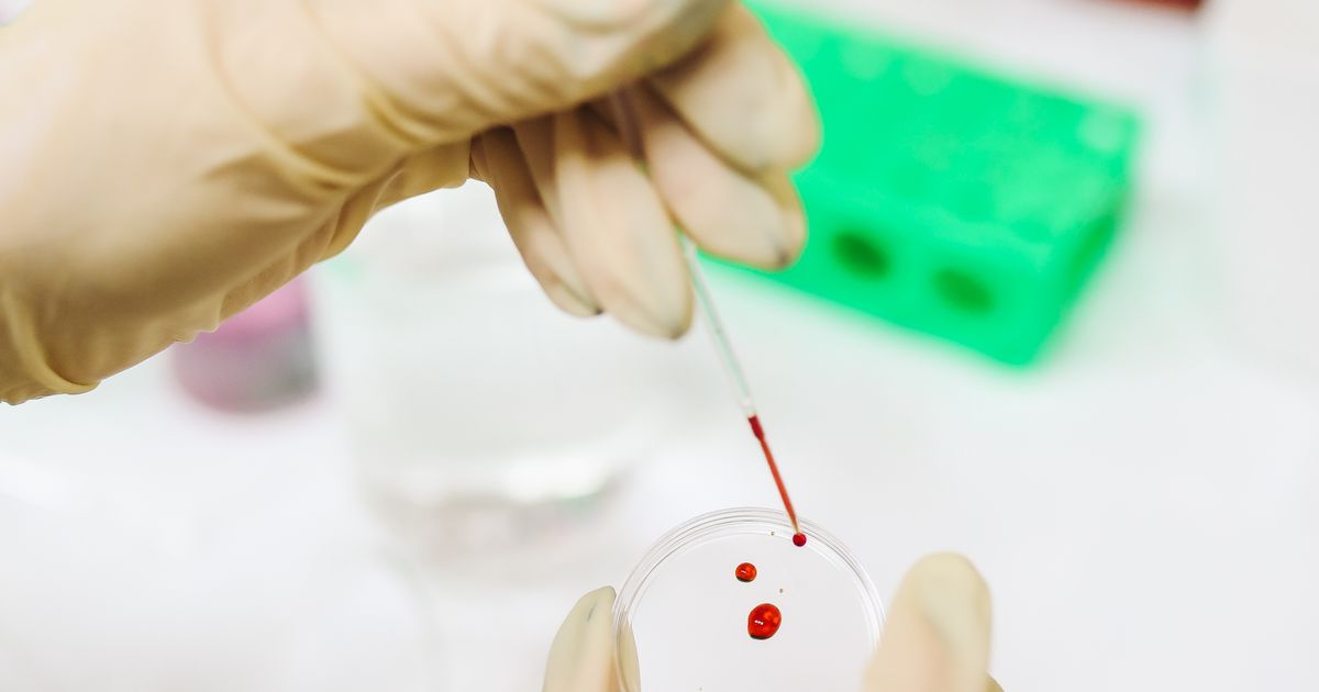 A gloved hand dropping a blood sample from a pipette into a petri dish in a laboratory, illustrating the rules on advertising for clinical trial participants in Singapore.